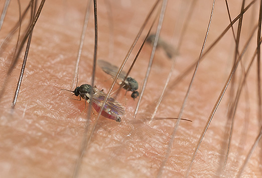 Mouche De L Olivier Piqure Sur L Homme Arthropodes et maladies | Medscape France
